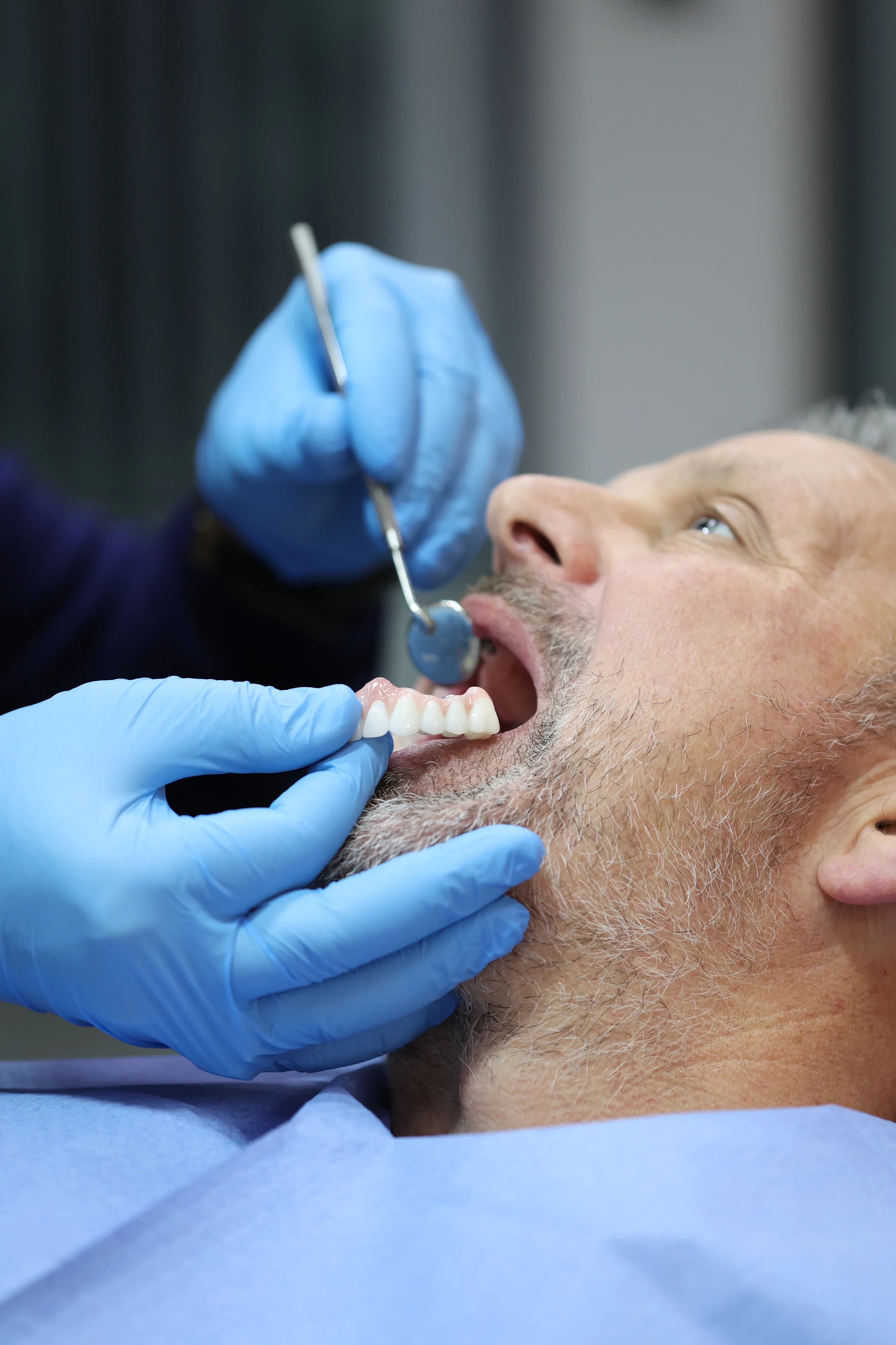 All-on-6 dental implants treatment at Dentoper Antalya