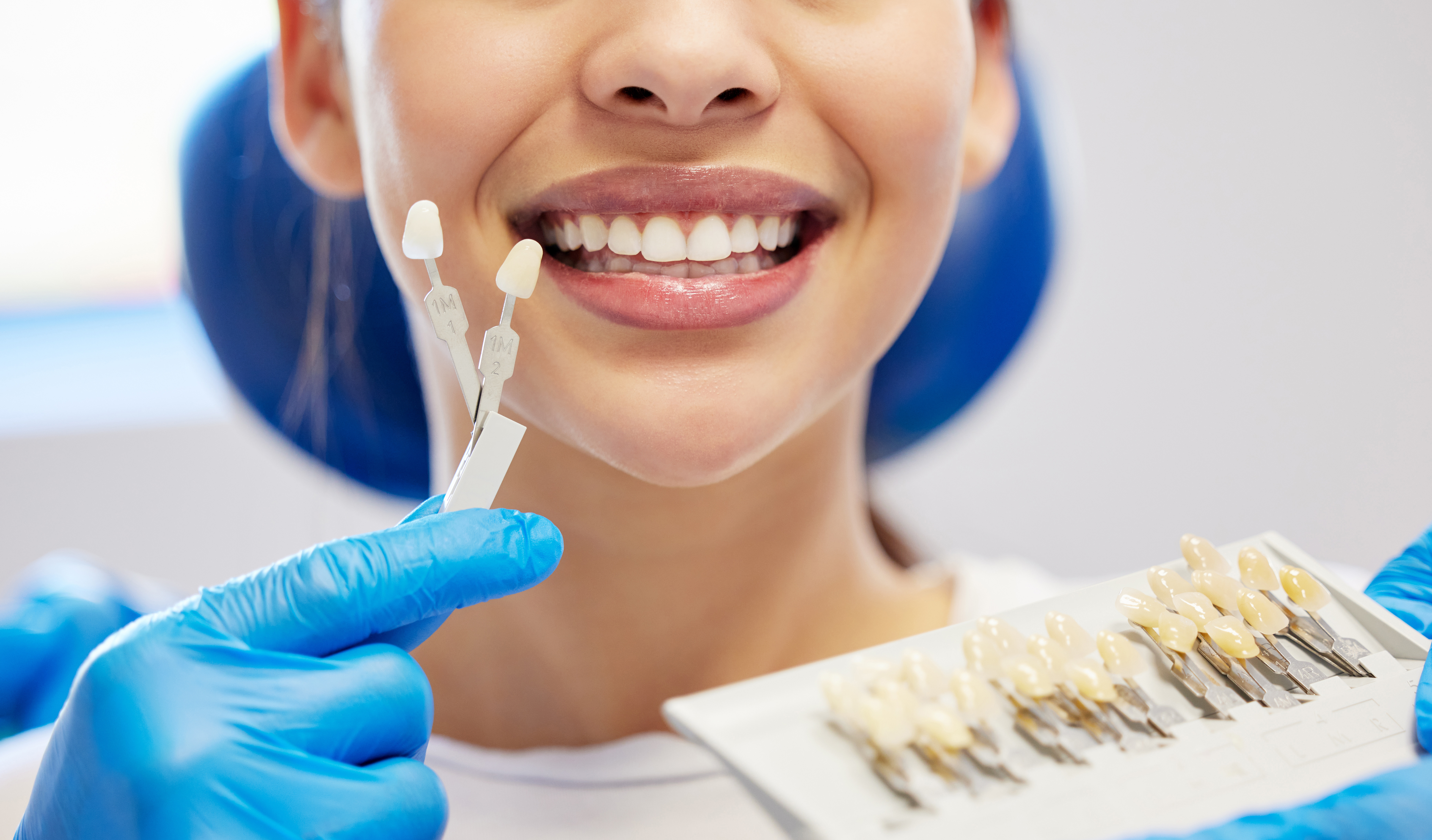 Veneers Detail