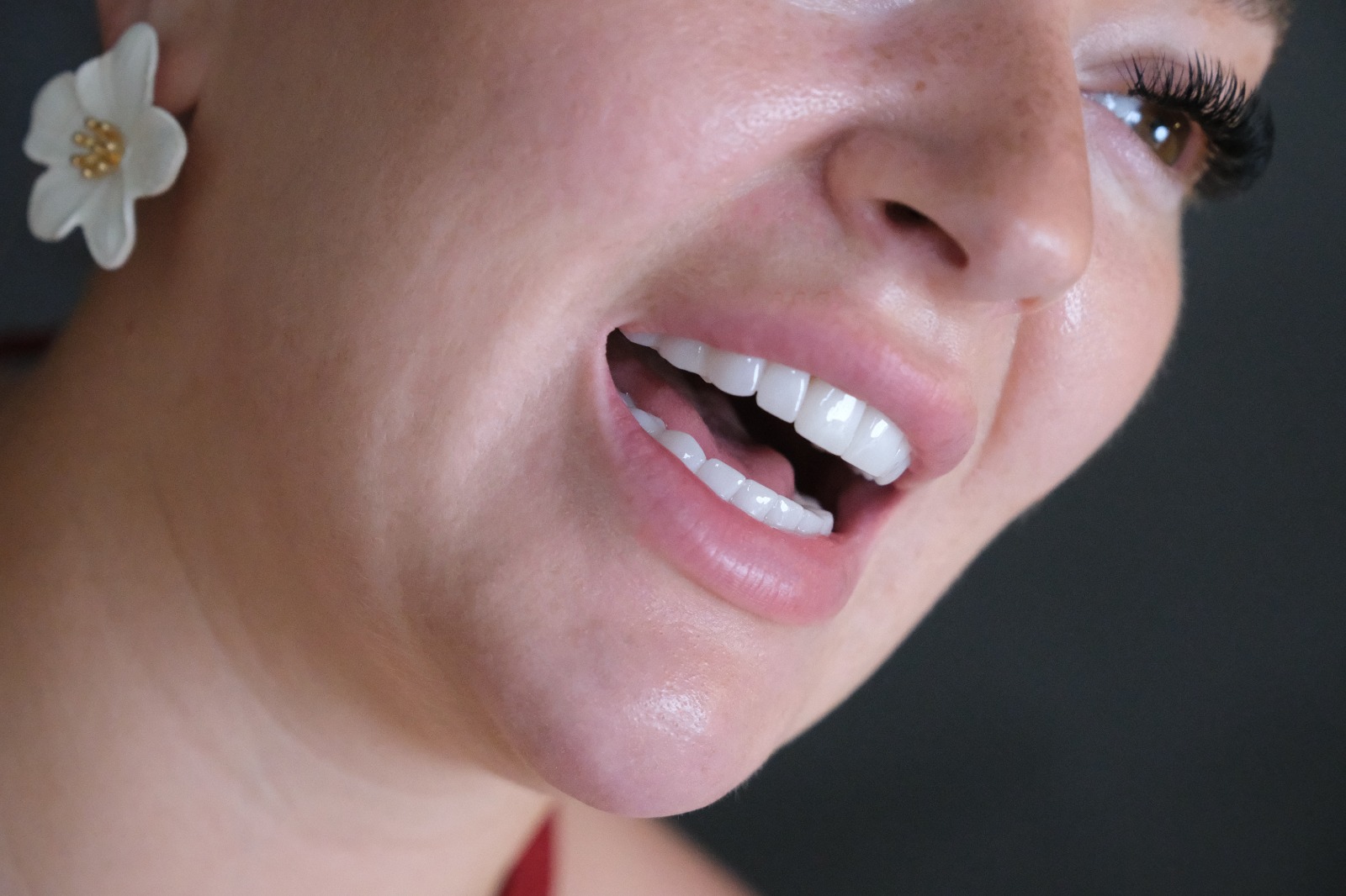 Dental Crowns in Turkey: Restore Your Smile – Antalya